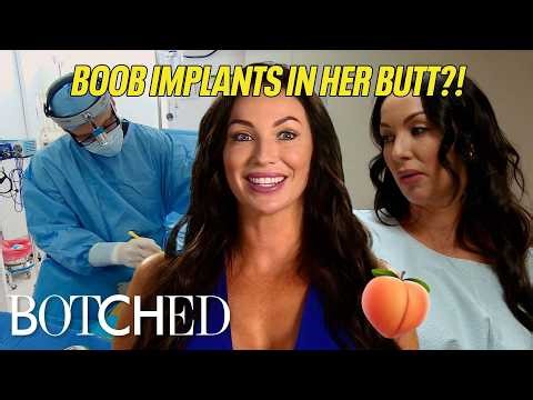 Jana's Grandma Says Her Butt Implants Look Like Ruptured Testicles?! (Before & After) | Botched | E!