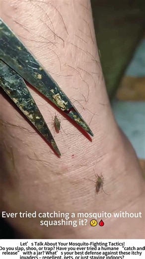 Mosquito Removal with Tweezers – A Gentle (But Unusual) Approach 🦟🔍