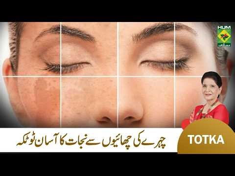 Zubaida Apa’s Tip: How to Get Rid of Freckles | Skin Care | Masala TV