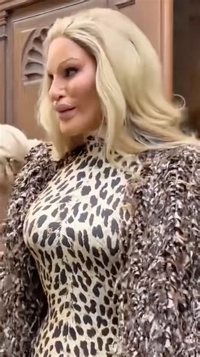 Celebrities who's Plastic surgery turns into a disaster 😳😵 #celebritynews #hollywoodcelebrity #plasticsurgery #kattyperry #katyperry #peteburns #michaeljacksonfan #donatellaversace💜 #carrottop #jocelyn #charlottecrosby #simoncowell #celebritygossip #hollywood #hollywoodlife | Real life