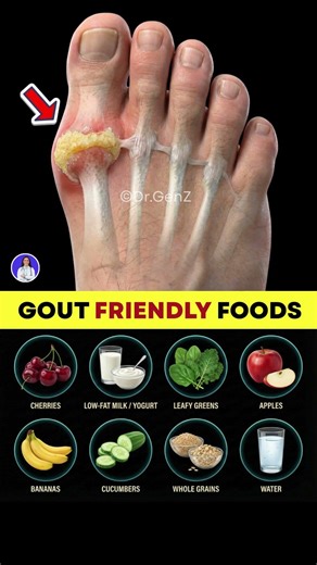 Top Gout Friendly Foods Doctors Recommend | Gout Diet Plan