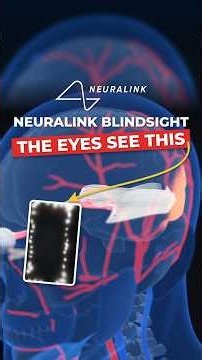How Elon Musk’s NEURALINK BLINDSIGHT Would Let Blind People See Without Eyes