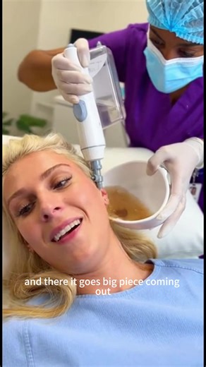 Effective Earwax Removal Procedure