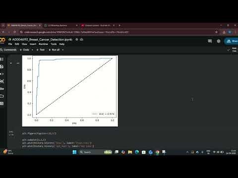 Breast Cancer Detection Using Deep Learning & Grad-CAM: A Comparative Analysis of CNN & ResNet Model