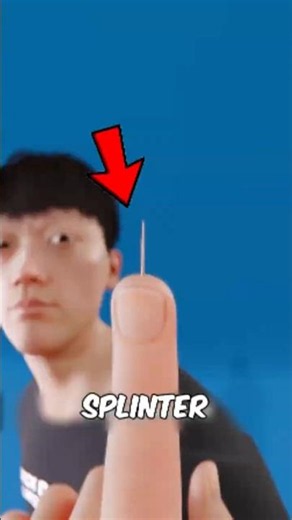 Removing Splinters Wrong?