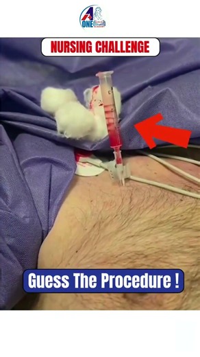 Guess the procedure and let us know in the comments ✅ 👇#shorts #nursing #aonenursingacademy