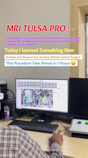 Radiology Vibes on Instagram: "MRI TULSA Pro TULSA-PRO (Transurethral Ultrasound Ablation) is a minimally invasive, MRI-guided robotic procedure for treating localized prostate cancer and BPH. 😇🤌🏼 Learn something new 😍🇮🇳"