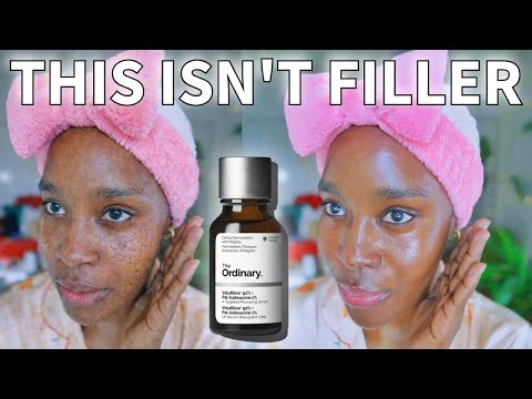 Why the Ordinary Volufiline “Filler in a bottle” won’t give you filler results (And Why that’s Ok)