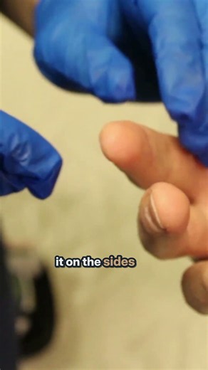 Why do they prick the side of your finger?