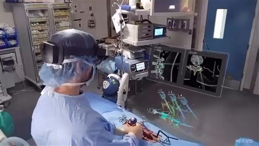 Use of augmented reality and AI to assist surgeons during spinal procedures, improving precision and visualization in real time. [📹Medivis]