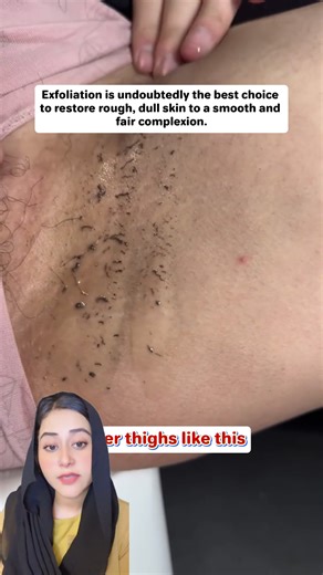 SHE Eureka ✨Chlorella Vulgaris gel pengelupasan✨dirumus dengan tepat dengan pelbagai ekstrak tumbuhan. 👍Ia pergi betul-betul di mana ia perlu masuk ke dalam kulit untuk meningkatkan kelicinan, keputihan, dan kecerahan. 😘Anda layak mendapatnya! #sheeureka #exfoliatinggel #exfoliating #fyp rcmy1562