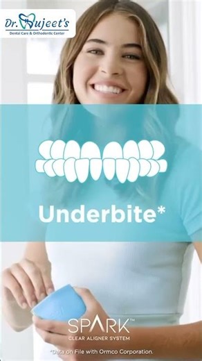 Spark™ Clear Aligners | Invisible Teeth Straightening at Dr. Sujeet’s Dental Clinic Pune #shorts