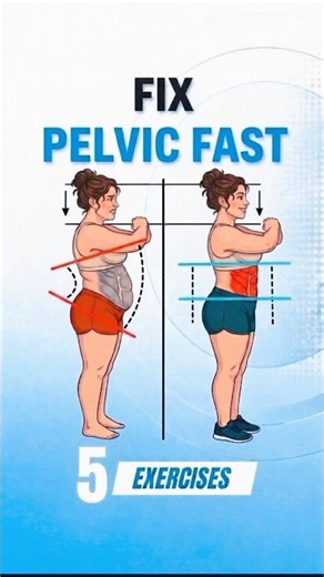 5 Easy Pelvic Floor Correction Exercises 🔥