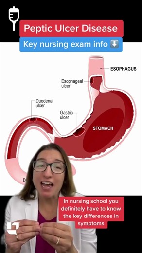 🩺 Cathy Explains: Peptic Ulcer Disease, Gastric vs Duodenal Ulcers MedSurg: SHORT @LevelUpRN