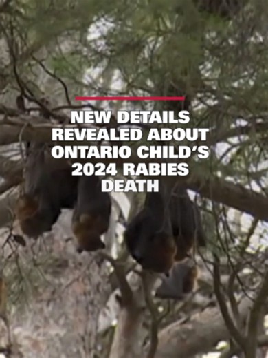 Doctors are urging people to seek medical attention if they have any contact with bats to prevent potential rabies infection. In Monday’s issue of the Canadian Medical Association Journal, infectious disease physicians described the case of a child who died of rabies almost two years ago. “It was important to us and to the family to take the opportunity to find learning experiences and lessons that we could take from his case to try and help spread awareness and understanding of rabies infection