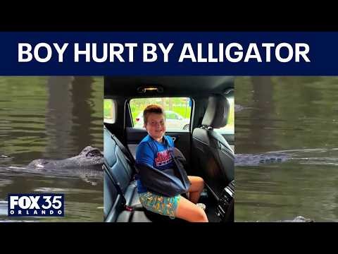 Boy attacked by alligator during Florida father-son fishing trip, family says