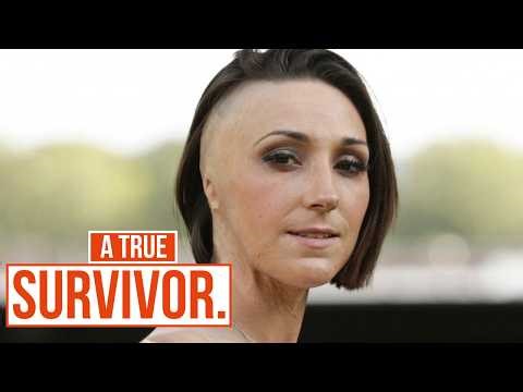 The Powerful Story of Adele Bellis, Acid Attack Survivor | Survivors | True Crime Central