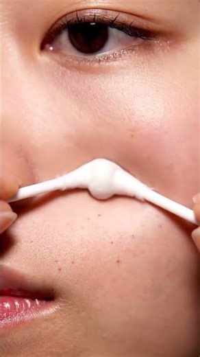 Best Blackhead Removal Today #skincleanse #popping #pimplefree