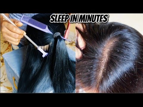 Brain Melting Hair Scratching ASMR for Deep Sleep || Extremely Gentle ASMR Hair Brushing