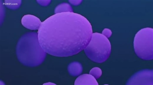 Drug-resistant Candida auris fungus rises in Connecticut