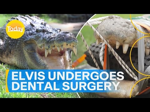 Elvis the five-metre croc undergoes detailed dental surgery | Today Show Australia