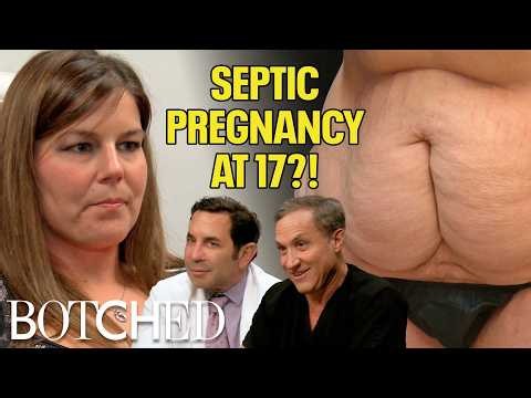 90% Chance of DEATH?! Jessica Survived Sepsis After Teen Pregnancy (Before & After) | Botched | E!