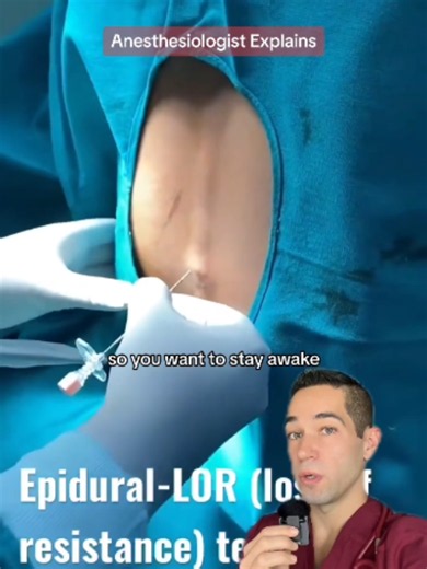 How to stay awake during surgery 🤯 #epidural #doctor #anesthesiologist #medical