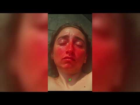 13 Essential First Aid Tips For Emergencies | Compilation