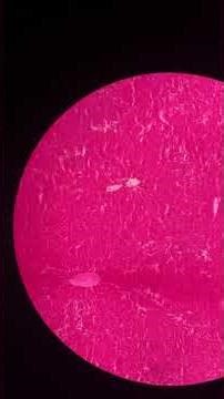 Call :-8787597015. BMLT (Bachelor of Medical Laboratory Technology) is an undergraduate course .