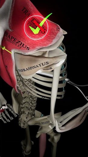 🔥Rotate, Don’t Retract 🎯