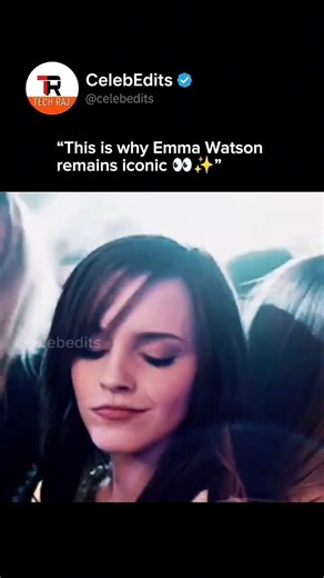 What's Happened to the Emma Watson watch till end 😭😱🔥