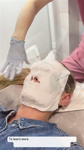 Inmode Lumecca IPL at Revive AEsthetic Clinic