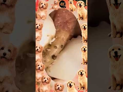 Blackheads Removal #641 | Acne Treatment and Very Satisfying Satisfying Pimple pop #blackheads