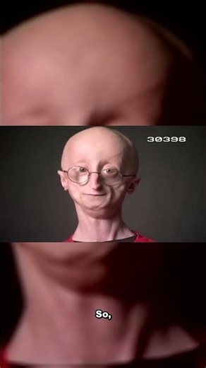 A 13-year-old Sam explains his disease in 36 seconds. It'll stop you cold.