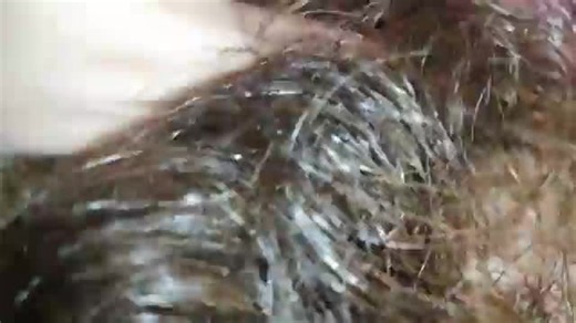 New hairy pussy compilation close up gaping big clit bush by cutieblonde