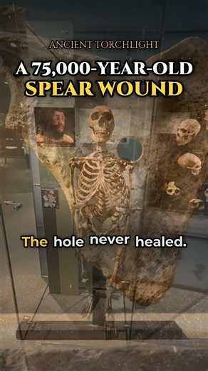 Shanidar Neanderthal: A 75,000-Year-Old Spear Wound Mystery