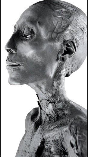 Mummy of Thutmose IV – Scientific Evidence of Illness, Belief, and Royal Burial Practices The mummy of King Thutmose IV offers a rare and scientifically significant insight into the physical condition, funerary ideology, and medical realities of Egypt’s New Kingdom rulers. Discovered in 1898 within the Royal Mummy Cache at KV35 by Victor Loret, the king’s body had been relocated in antiquity by ancient priests, a protective measure taken during periods of tomb robbery to safeguard royal remains.