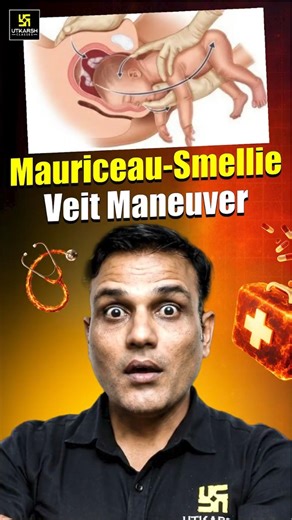 Mauriceau-Smellie Veit Maneuver | MSV Maneuver Explained | Shailendra Sir | #utkarshnursing