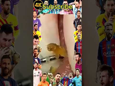 Blackheads Removal #210 | Acne Treatment and Very Satisfying Satisfying Pimple pop #blackheads