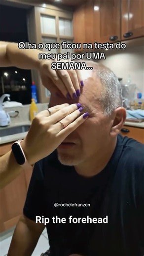 Rip the forehead