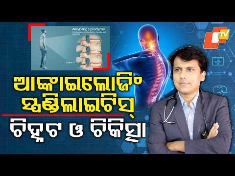 Doctor Doctor || 03 MAY 20026 || What is Ankylosing spondylitis & Symptoms and Treatment || Otv