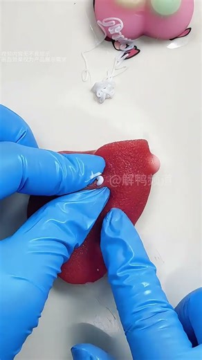 “INSANE Pimple Popping 😱 Most Satisfying Cyst Removal Ever!”