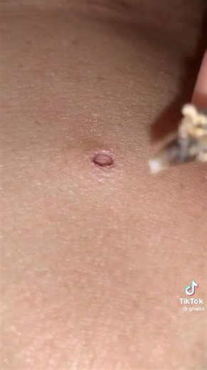 Pop Explosion! 🤯