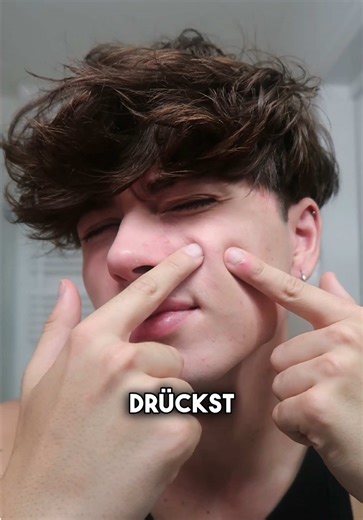 Effective Pimple Patch Trick for Clearer Skin