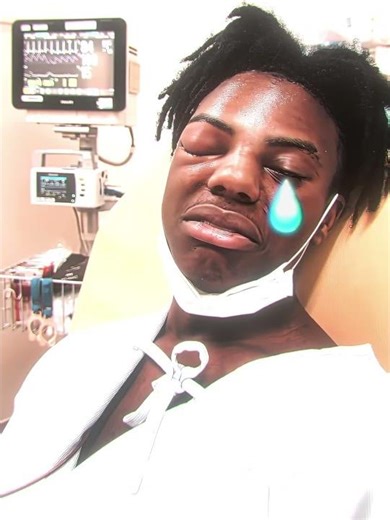 IShowSpeed Got Injured Badly..