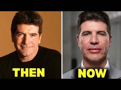 15 Shocking Celebrity Plastic Surgery Fails That Left Them Unrecognizable | Then and Now 2025