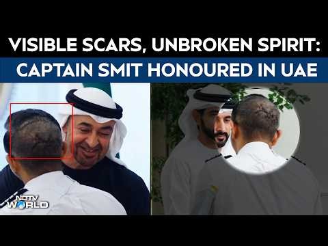 Captain Smit Machchhar Appears With Visible Head Wounds During UAE President Meet | Flydubai Attack