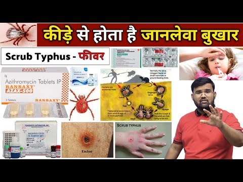 कीड़ों से होता है बुखार | Scrub Typhus Fever | Fever Treatment | Fever Management | Treatment | MBBS