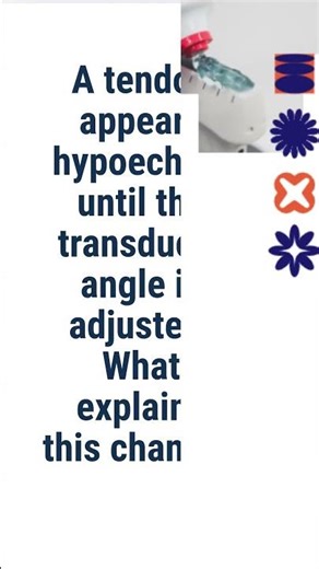 SPI Anisotropy: Why Tendons Go Dark Until You Angle Correctly