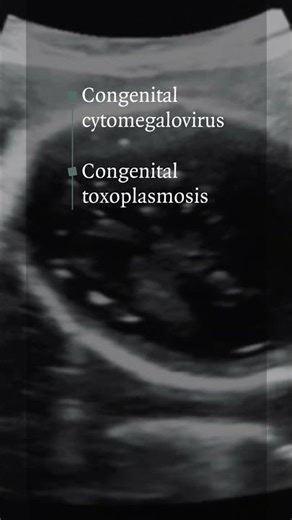 Image Challenge — December 18, 2025